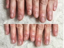 グラシナ なんば店/深爪/自爪育成/フィルイン