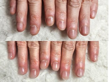 グラシナ なんば店/深爪/自爪育成/フィルイン