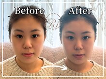 R-1ビューティーサロン 銀座/Before＆After