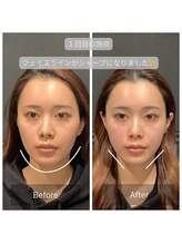 サリエ(S'allier)/お客様のビフォーアフター