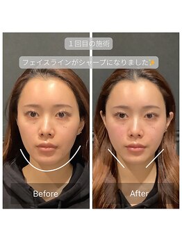 サリエ(S'allier)/お客様のビフォーアフター