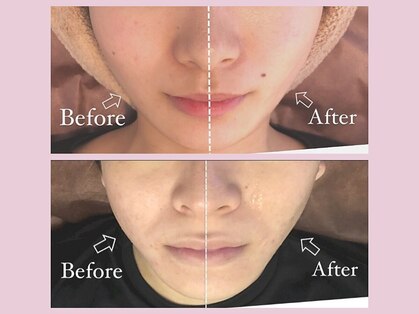 リフト 八王子(Lift)の写真