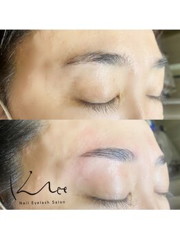 クレー(Klee)/アイブロウリフト