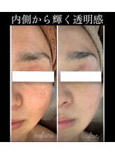 アンパス(Unpas)/継続は美肌力なり♪