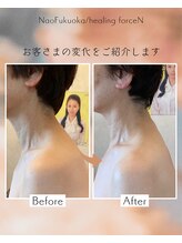 ナオフクオカ ヒーリングフォースエヌ(NaoFukuoka/healingforceN)/首の位置が変わる？！