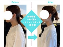 ビーキューオーエル(美QOL)/症例写真