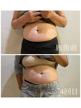 和ごころ本格痩身/