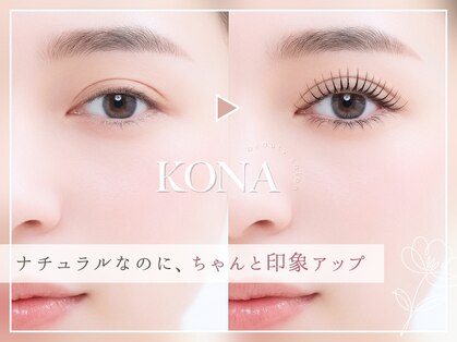 コナ(KONA)の写真