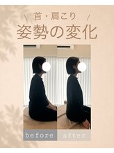 アオ 香椎(AO)/before→after
