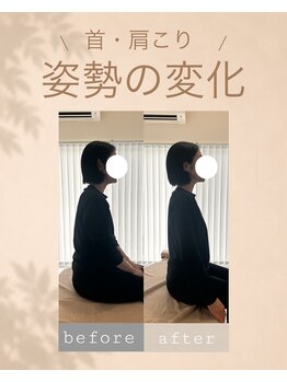 アオ 香椎(AO)/before→after