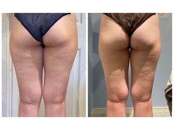 ルナグランデ(Luna grande.)/効果写真