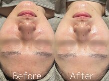 マイナプラ 表参道(myna+)/