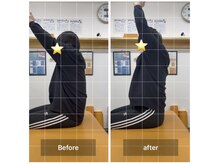 ナオル整体 飯田橋院(NAORU整体)/Before After/飯田橋/整体・矯正