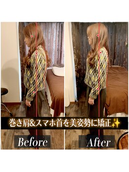 てんてんてんまてん/姿勢矯正/骨盤矯正/整体/巻き肩