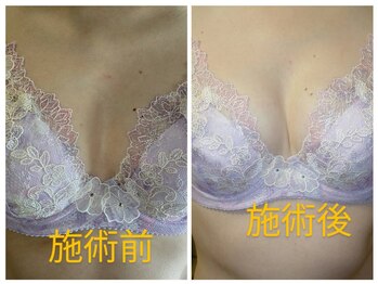 リラックスジュリー/下腹部、上半身集中コース4000円