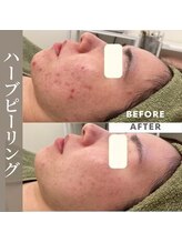 エステティックサロンR/本気で肌質改善