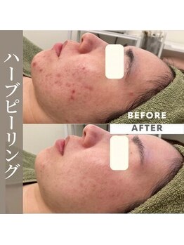 エステティックサロンR/本気で肌質改善