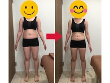 美容整体院元 光の森店/30代T.S様のビフォーアフター