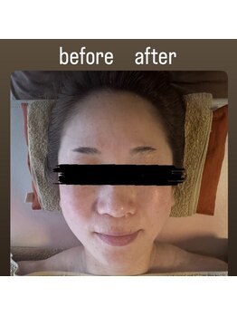 スゴ腕の施術者がいるサロン