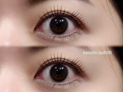 ヒノア(Hinoa)の写真