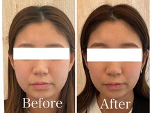 サロンベイビー 西宮本店(Salon Baby)/小顔美容整顔×上半身整体　