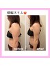 最安値◎【痩身レモンボトル】1箇所集中×ラジオ派×痩身マッサージ効果up