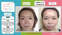 小顔整体研究所 KSラボ 鳴海店