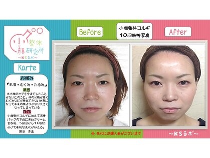 小顔整体研究所 KSラボ 鳴海店の写真