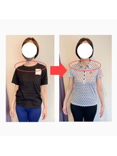 リベスト(RE:BEST)/当院の＜全身矯正メニュー＞効果