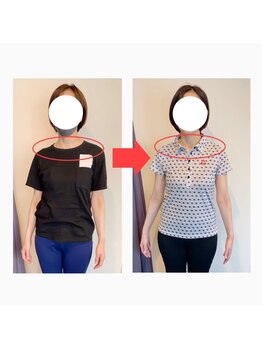 リベスト(RE:BEST)/当院の<全身矯正メニュー>効果