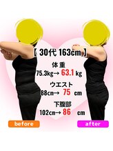 さらさ整骨院/ダイエット整体ビフォーアフター