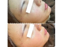 ピエル 北千住店(PIEL)/クリスティーナアンストレス