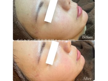 ピエル 北千住店(PIEL)/クリスティーナアンストレス