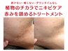 【ニキビケア】繰り返すポツポツ・赤みを集中ケア/お出かけ前も自信を持てる!