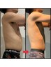 内臓脂肪から落とす！ぽっこりお腹撃退！【WINBACK腸もみデトックス痩身】