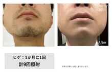 エムエスアイ(MSI)