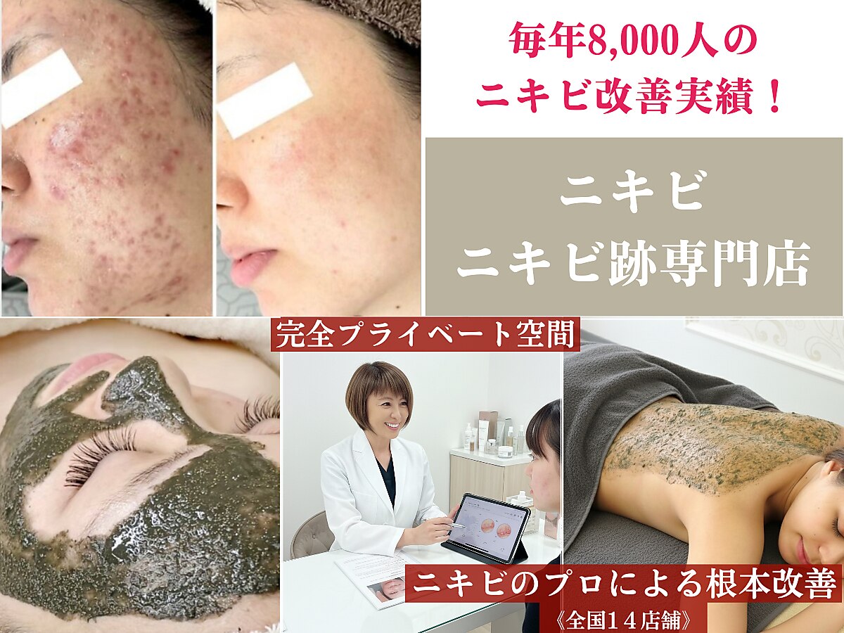 ニキビ研究所 千葉店｜ホットペッパービューティー