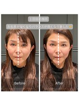 サリエ(S'allier)/お客様のビフォーアフター