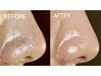 鍼灸フェイシャルサロンさつきの写真