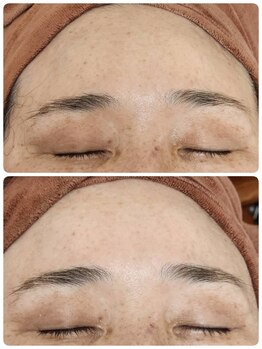 プレイス 堂山本店(PLACE)/ハーブピーリング