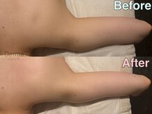ダーマ(Derma)の雰囲気（痩せにくい二の腕もスッキリ◎ブライダルメニューでもオススメ♪）