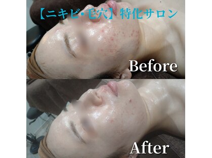 ボーソリューション(Beau-Solution)の写真