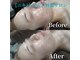 ボーソリューション(Beau-Solution)の写真