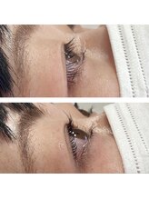 モワメーム(moi meme)/逆まつげお悩み解消