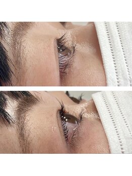 モワメーム(moi meme)/逆まつげお悩み解消