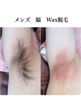 エヌティー 時津店(N T)/WAX脱毛