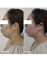 ヴェルシック(Belchic)/圧倒的な効果と満足感を実感