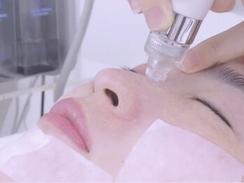 MK鍼灸整骨院 堀江店の写真/【大人気！毛穴洗浄＆高濃度アンプル】ハリ艶・弾力・もちっ♪トーンUP効果＆化粧ノリUP◎初めての方にも！