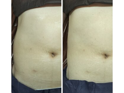 ラボーテ(La Beaute)の写真