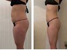 【ダイエットのお悩み】絶対痩せたい！ダイエットモニター無料カウンセリング